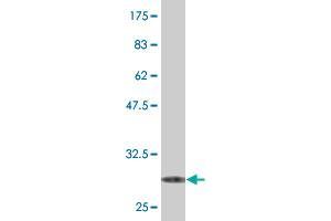 Western Blot detection against Immunogen (29. (SRD5A2 抗体  (AA 28-65))