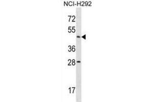 Western Blotting (WB) image for anti-Actin-Like 7b (Actl7b) antibody (ABIN2998793) (Actl7b 抗体)