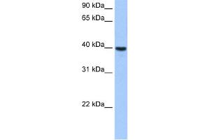 WB Suggested Anti-ST6GALNAC4 Antibody Titration:  0. (ST6GALNAC4 抗体  (Middle Region))