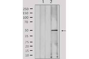 Western blot analysis of extracts from Hela, using FKRP Antibody. (FKRP 抗体  (N-Term))