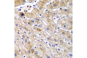 Immunohistochemistry of paraffin-embedded human liver injury using DPP3 antibody (ABIN6292042) at dilution of 1:100 (40x lens). (DPP3 抗体)