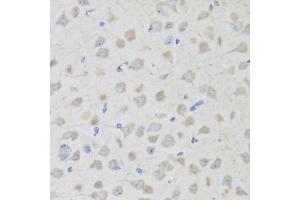 Immunohistochemistry of paraffin-embedded mouse brain using PENK antibody (ABIN6133151, ABIN6145444, ABIN6145445 and ABIN6221906) at dilution of 1:100 (40x lens). (Enkephalin 抗体  (AA 25-267))