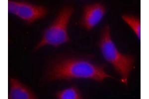 Immunofluorescence staining of methanol-fixed Hela cells using Tau(Phospho-Ser262) Antibody. (MAPT 抗体  (pSer262))