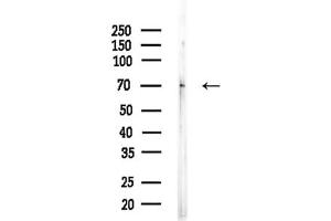 Western blot analysis of lysates from Mouse brain, using BTRC Antibody at 1/1000 dilution.