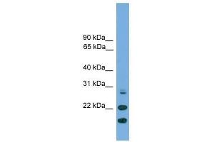 ASF1A antibody used at 0. (ASF1A 抗体  (N-Term))