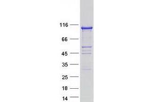 Validation with Western Blot (ITPKC Protein (Myc-DYKDDDDK Tag))