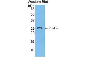 Western blot analysis of the recombinant protein. (FKBP8 抗体  (AA 110-329))