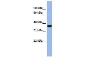FANCL antibody used at 1 ug/ml to detect target protein.