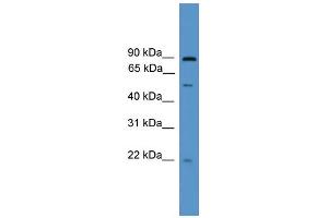 WB Suggested Anti-OAZ3 Antibody Titration: 0.