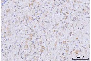 IHC analysis of RARS/RARS1 using anti-RARS/RARS1 antibody (ABIN7600223). (Probable Arginine--tRNA Ligase, Cytoplasmic (RARS-1) (AA 165-425) 抗体)