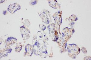 Anti-Galectin 3 Picoband antibody,  IHC(P): Human Placenta Tissue (Galectin 3 抗体  (AA 139-250))