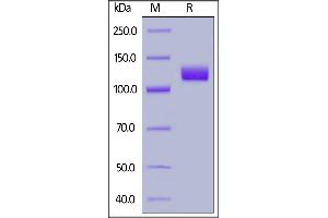 SDS-PAGE (SDS) image for Folate Hydrolase (Prostate-Specific Membrane Antigen) 1 (FOLH1) (AA 44-750) (Active) protein (Fc Tag) (ABIN7013426)