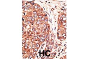 Immunohistochemistry (IHC) image for anti-Septin 9 (SEPT9) antibody (ABIN3002552) (Septin 9 抗体)