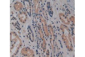 Used in DAB staining on fromalin fixed paraffin-embedded Heart tissue (NOSIP 抗体  (AA 62-295))