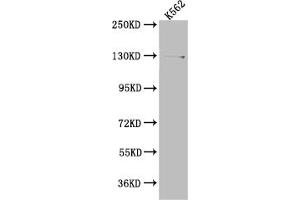Western Blot Positive WB detected in: K562 whole cell lysate All lanes: HAUSP antibody at 1:1000 Secondary Goat polyclonal to rabbit IgG at 1/50000 dilution Predicted band size: 129, 127 kDa Observed band size: 140 kDa (Recombinant USP7 抗体)