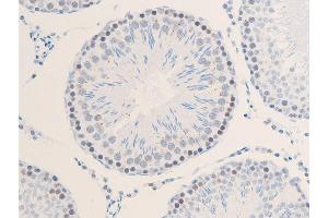 ABIN6267285 at 1/100 staining rat testicular tissue sections by IHC-P. (ErbB2/Her2 抗体  (pTyr1112))