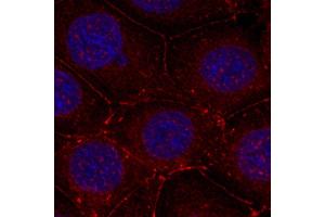 Immunofluorescence staining of methanol-fixed MCF-7 cells using Phospho-IGF1R-Y1161 antibody (ABIN2988064). (IGF1R 抗体  (pTyr1161))