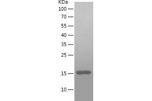 TOMM20 Protein (AA 23-145) (His tag)