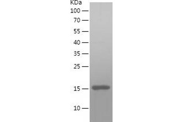 TOMM20 Protein (AA 23-145) (His tag)