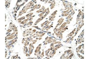 Immunohistochemistry (IHC) image for anti-Solute Carrier Family 6 (Neurotransmitter Transporter, Creatine), Member 8 (SLC6A8) antibody (ABIN630409)