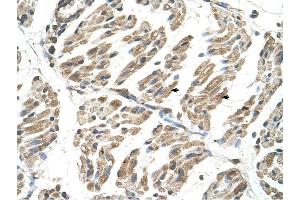 SLC6A8 antibody was used for immunohistochemistry at a concentration of 4-8 ug/ml to stain Skeletal muscle cells (arrows) in Human Muscle. (SLC6A8 抗体)