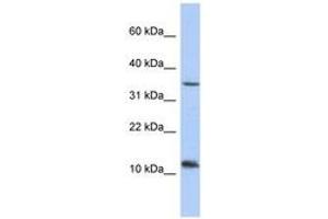 Image no. 1 for anti-Nucleoredoxin-Like 2 (NXNL2) (AA 71-101) antibody (ABIN6743672) (NXNL2 抗体  (AA 71-101))