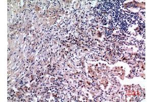 Immunohistochemistry (IHC) analysis of paraffin-embedded Human Lung, antibody was diluted at 1:100. (IL-6 抗体  (Internal Region))