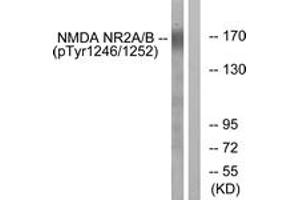 Western Blotting (WB) image for anti-Glutamate Receptor, Ionotropic, N-Methyl D-Aspartate 2A/B (GRIN2A/B) (AA 1216-1265), (pTyr1246) antibody (ABIN1531617) (NMDAR2A + 2B 抗体  (pTyr1246))
