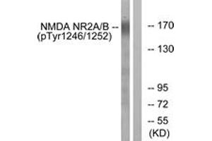 Western Blotting (WB) image for anti-Glutamate Receptor, Ionotropic, N-Methyl D-Aspartate 2A/B (GRIN2A/B) (AA 1216-1265), (pTyr1246) antibody (ABIN482229) (NMDAR2A + 2B 抗体  (pTyr1246))