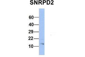 Western Blotting (WB) image for anti-Small Nuclear Ribonucleoprotein D2 Polypeptide 16.5kDa (SNRPD2) (Middle Region) antibody (ABIN2778903)