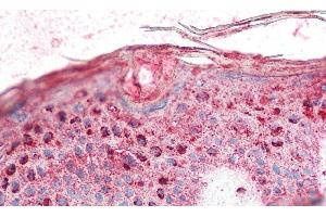 Immunohistochemistry (IHC) image for anti-Kallikrein 8 (KLK8) (AA 29-260) antibody (ABIN7432394)