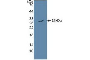 Detection of Recombinant PRKAa2, Human using Polyclonal Antibody to Protein Kinase, AMP Activated Alpha 2 (PRKAa2) (AMP Activated Protein Kinase Alpha2 (AA 252-493) 抗体)