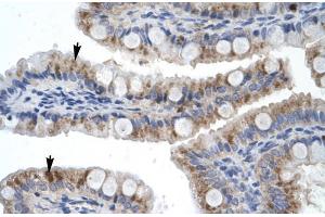 Human Intestine; Rabbit Anti-ZNF341 Antibody. (ZNF341 抗体  (Middle Region))