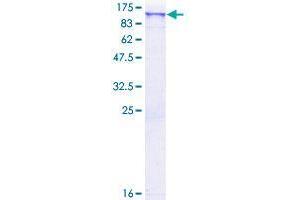 SCYL2 Protein (AA 1-929) (GST tag)