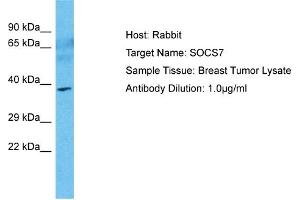 Host: Rabbit Target Name: SOCS7 Sample Type: Breast Tumor lysates Antibody Dilution: 1. (SOCS7 抗体  (N-Term))