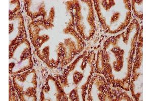 IHC image of ABIN7142103 diluted at 1:221 and staining in paraffin-embedded human prostate tissue performed on a Leica BondTM system. (14-3-3 theta 抗体  (AA 1-245))