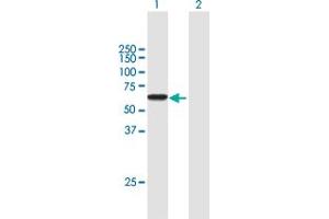 Western Blot analysis of IKZF1 expression in transfected 293T cell line by IKZF1 MaxPab polyclonal antibody. (IKZF1 抗体  (AA 1-477))