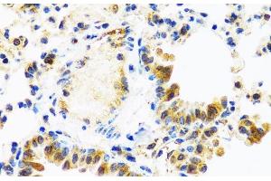 Immunohistochemistry of paraffin-embedded Mouse lung using C8orf4 Polyclonal Antibody at dilution of 1:100 (40x lens). (C8orf4 抗体)