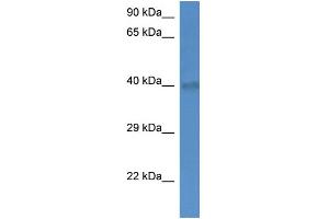 WB Suggested Anti-Slc25a27 Antibody   Titration: 1. (SLC25A27 抗体  (C-Term))