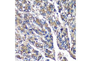 Immunohistochemistry (IHC) image for anti-F-Box Protein 21 (FBXO21) (AA 440-621) antibody (ABIN7267085)