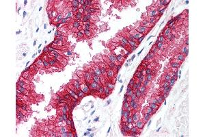 Immunohistochemistry (IHC) image for anti-Potassium Intermediate/small Conductance Calcium-Activated Channel, Subfamily N, Member 4 (KCNN4) (C-Term) antibody (ABIN1048993)