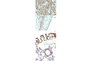 Immunohistochemical staining (Formalin-fixed paraffin-embedded sections) of (A) human tonsil (B) human tonsil (C) rat colon and (D) rat lung with Nuclear antigen monoclonal antibody, clone NM106 . (Nuclear Antigen 抗体)