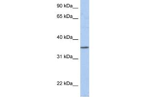 WB Suggested Anti-PRR18 Antibody Titration: 0. (Proline Rich 18 抗体  (N-Term))