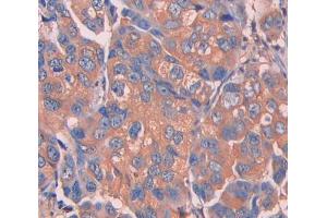 Immunohistochemistry (Paraffin-embedded Sections) (IHC (p)) image for anti-Uncoupling Protein 1 (Mitochondrial, Proton Carrier) (UCP1) (AA 179-296) antibody (ABIN2905048)