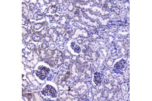 IHC analysis of VE Cadherin using anti-VE Cadherin antibody . (Cadherin 5 抗体  (AA 46-285))