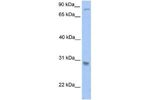 WB Suggested Anti-GSTT1 Antibody Titration:  0. (GSTT1 抗体  (C-Term))