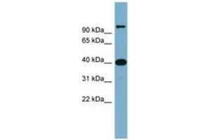 Image no. 1 for anti-Cyclin D-Type Binding-Protein 1 (CCNDBP1) (AA 179-228) antibody (ABIN6743832)