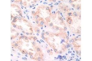 Used in DAB staining on fromalin fixed paraffin- embedded Kidney tissue (Fibronectin 抗体  (AA 2206-2337))