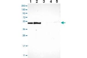 Western blot analysis of Lane 1: RT-4 Lane 2: U-251 MG Lane 3: Human Plasma Lane 4: Liver Lane 5: Tonsil with ECSIT polyclonal antibody ( Cat # PAB28035 ) at 1:100 - 1:250 dilution. (ECSIT 抗体)
