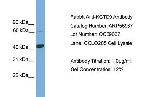 WB Suggested Anti-KCTD9  Antibody Titration: 0. (KCTD9 抗体  (Middle Region))